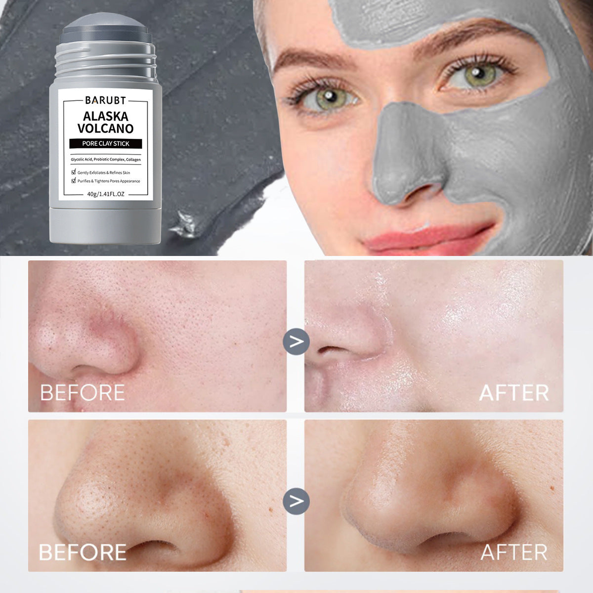 Gentle Blackhead Repair Facial Care Application Mask